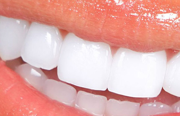 Veneers and Bonding: What they can do for your Smile and your Well-being